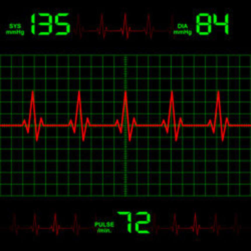 Why Palpitations or an Irregular Heartbeat Need Urgent Attention