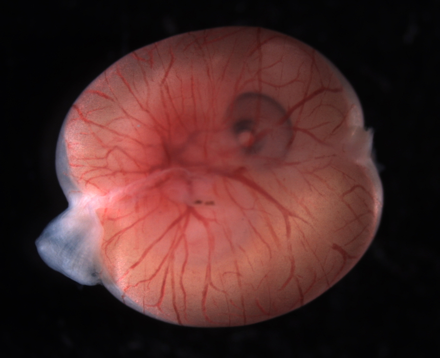 Using the Placenta to Understand How Complex Organs Evolve