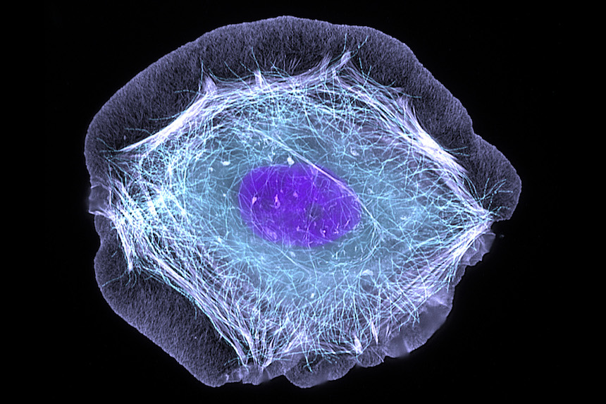 NIH Names Winners of “Follow That Cell” Phase 2 Competition