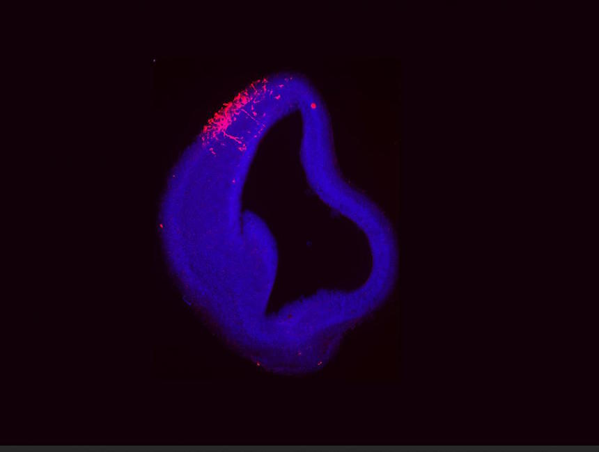 Mouse Study Sheds Light on Neural Risks Associated with Prenatal Alcohol Exposure