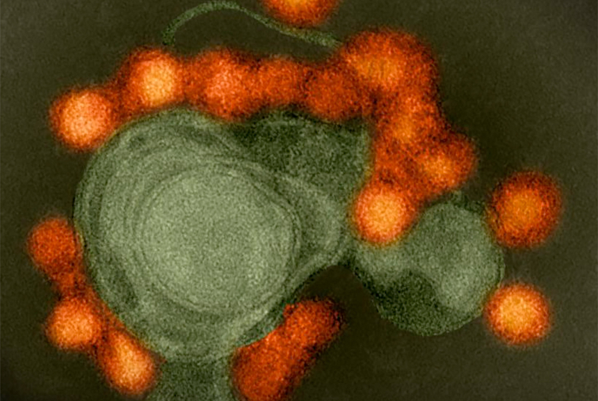 Malaria Drug Protects Fetal Mice from Zika Virus, NIH-Funded Study Finds