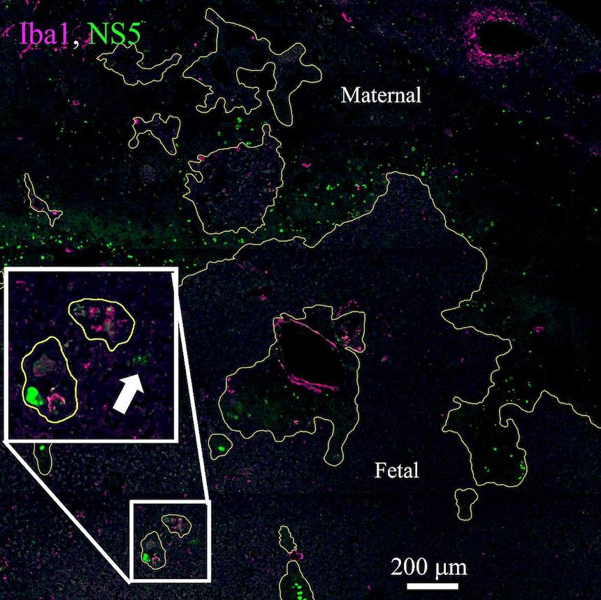 NIH Scientists Track Zika Virus Transmission in Mice