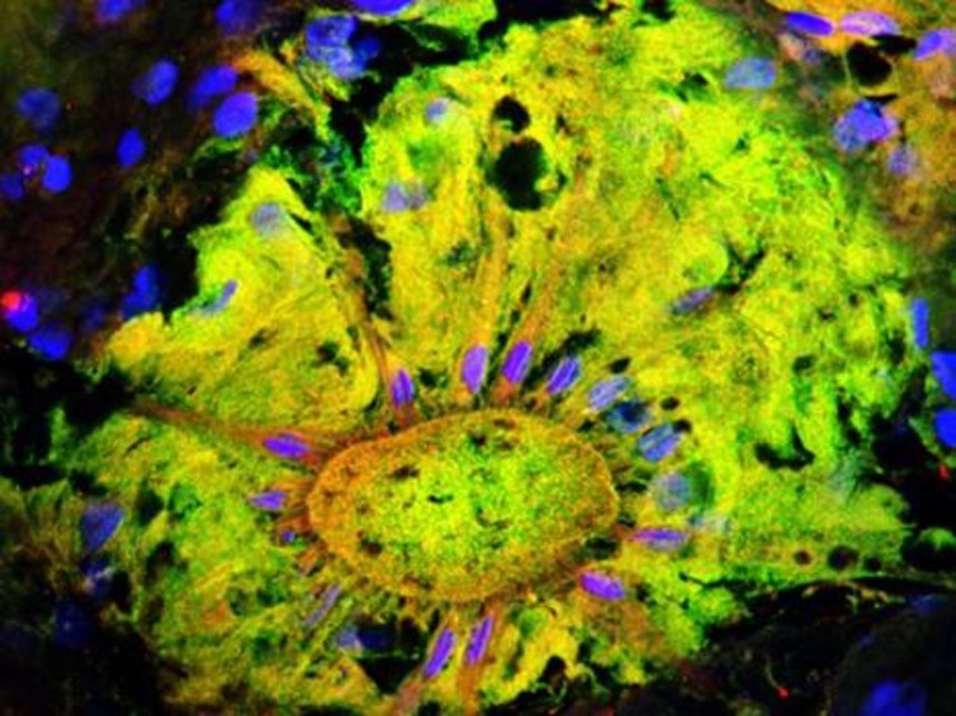 Seeing Without Eyes – the Unexpected World of Nonvisual Photoreception