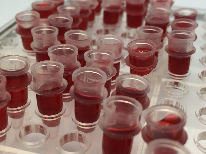 NIAID Scientists Illuminate Mechanism of Increased Cardiovascular Risks With HIV