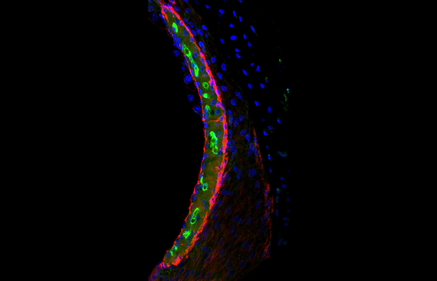 Study Uncovers Clues About Why Common Cancer Drug Causes Hearing Loss